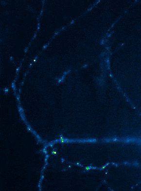 AMPA-Rezeptorinsertionsereignisse_anim