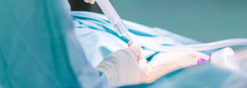 HeaderChirurgie