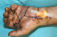Hand