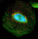 Immunfluoreszenfärbung eines menschlichen Podozyten