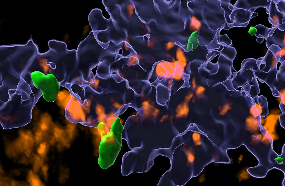 Immunzell-Interaktionen im Krebsgewebe