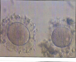In vitro gereifte Eizellen II