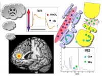 WAlter-Grafik-Bunte Flecken