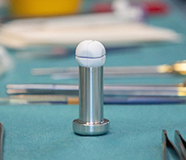RefluxStop_Implantat
