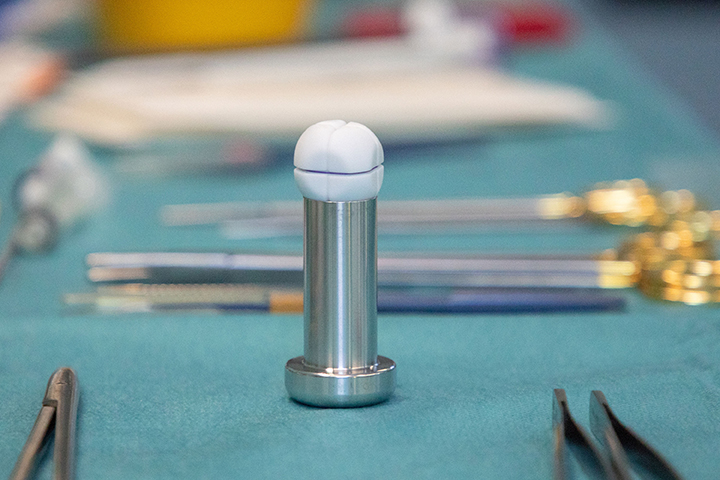 Foto1_RefluxStop_Implantat_Schubert_UMMD