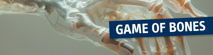 Game of Bones
