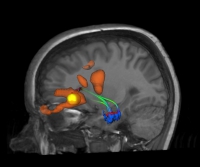 pa52_3D_fMRI_cut