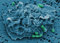 Makrophage mit GAS_Rohde