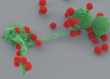 Foto: Neutrophile bei der Arbeit an A. fumigatus  Quelle: Prof. Matthias Gunze