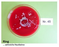 Abklatschuntersuchung 2016