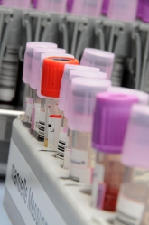 Tumordiagnostik im Blut